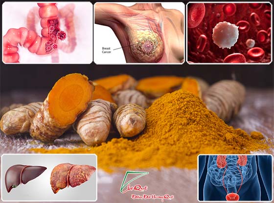 Tinh bột nghệ và chất curcumin chữa trị ung thư